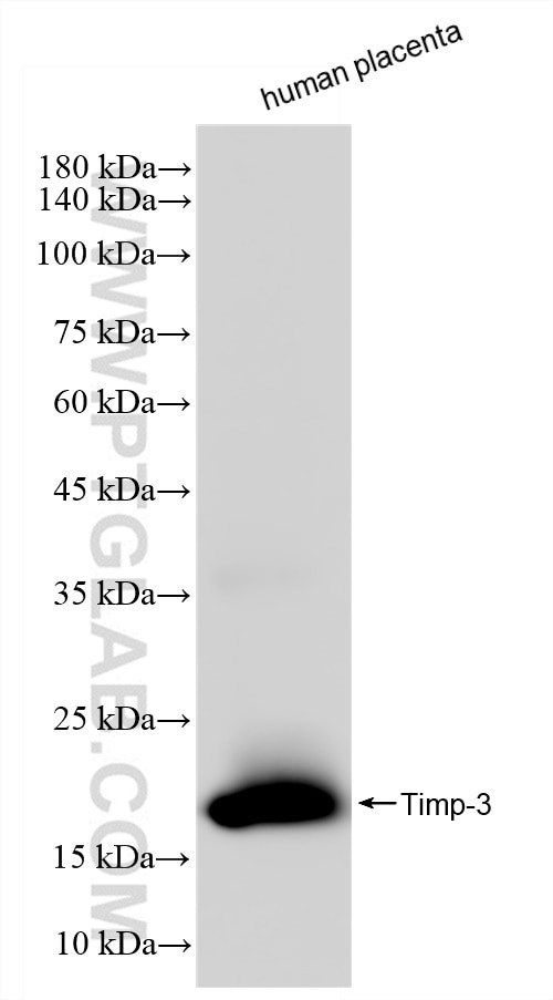 Timp-3 Antibody in Western Blot (WB)