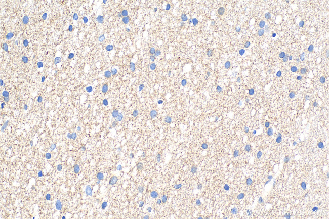 OPTN Antibody in Immunohistochemistry (Paraffin) (IHC (P))