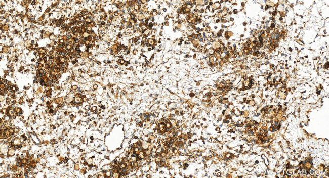 ATP6V1E1 Antibody in Immunohistochemistry (Paraffin) (IHC (P))
