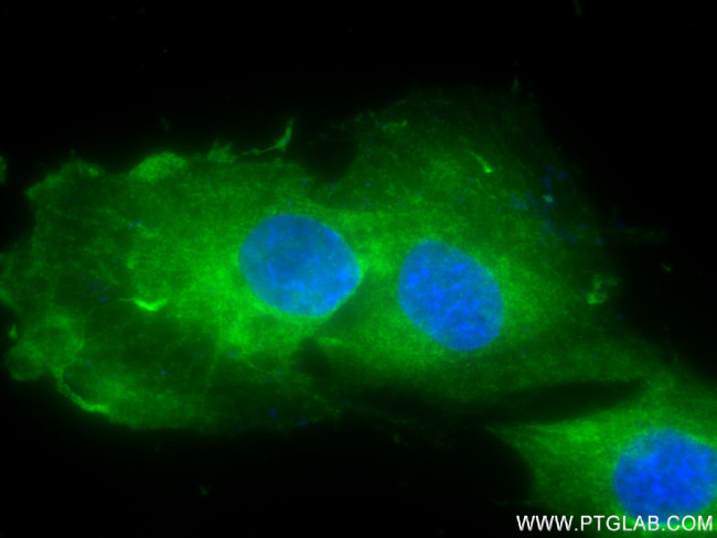 Synaptotagmin-1 Antibody in Immunocytochemistry (ICC/IF)