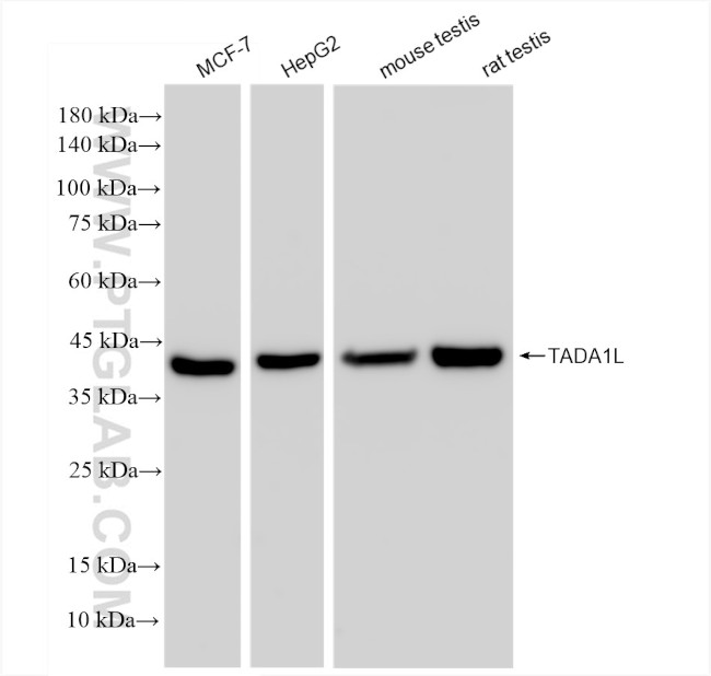 TADA1L Antibody in Western Blot (WB)