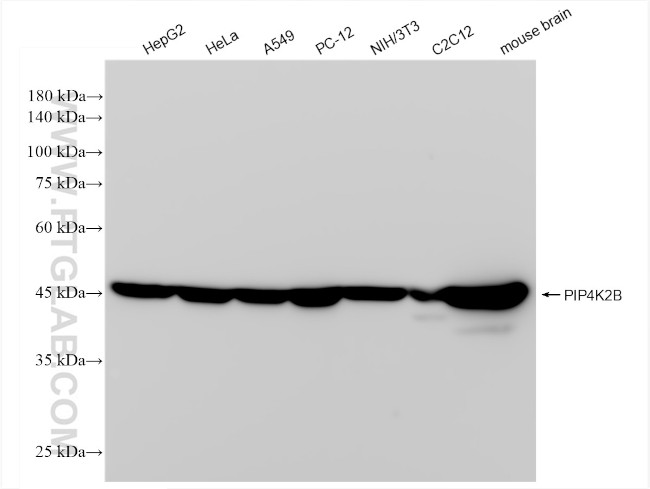 PIP4K2B Antibody in Western Blot (WB)