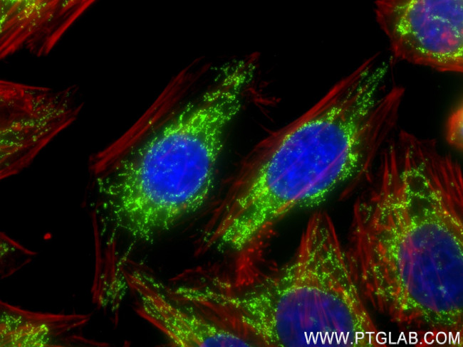 DLAT Antibody in Immunocytochemistry (ICC/IF)