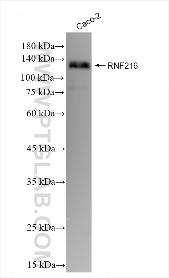 RNF216 Antibody in Western Blot (WB)