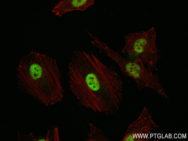 CDK9 Antibody in Immunocytochemistry (ICC/IF)