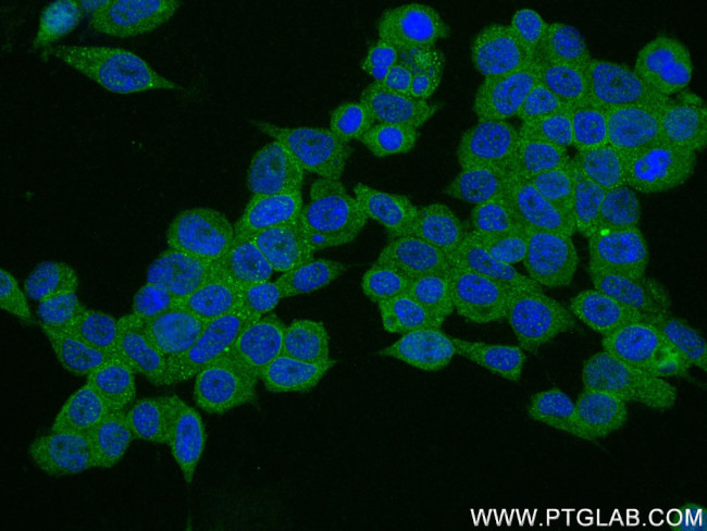 PHKG2 Antibody in Immunocytochemistry (ICC/IF)