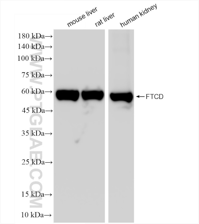 FTCD Antibody in Western Blot (WB)