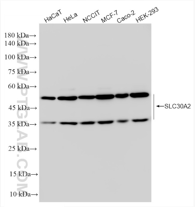 SLC30A2 Antibody in Western Blot (WB)