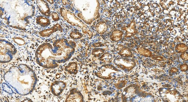 UQCRC2 Antibody in Immunohistochemistry (Paraffin) (IHC (P))