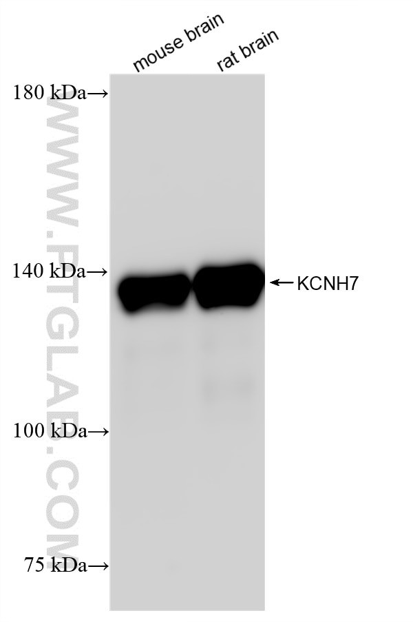 KCNH7 Antibody in Western Blot (WB)