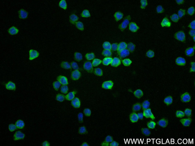 CHI3L1 Antibody in Immunocytochemistry (ICC/IF)