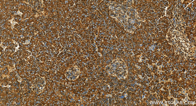 HSP47/SERPINH1 Antibody in Immunohistochemistry (Paraffin) (IHC (P))