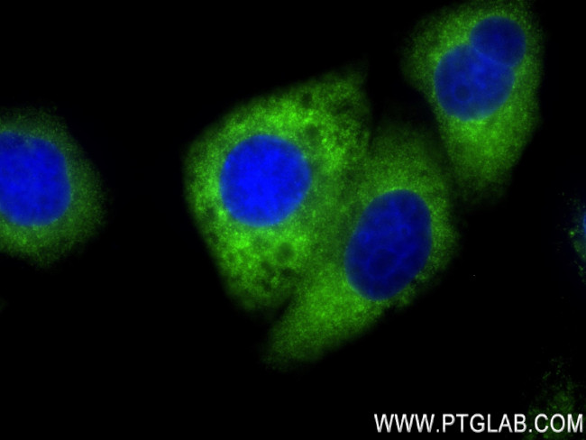 MARS Antibody in Immunocytochemistry (ICC/IF)