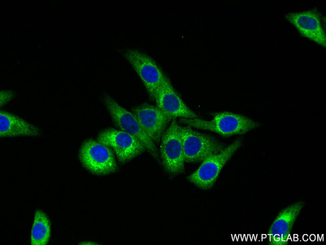 MARS Antibody in Immunocytochemistry (ICC/IF)