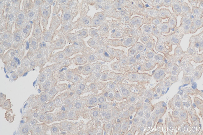 ASGR1 Antibody in Immunohistochemistry (Paraffin) (IHC (P))