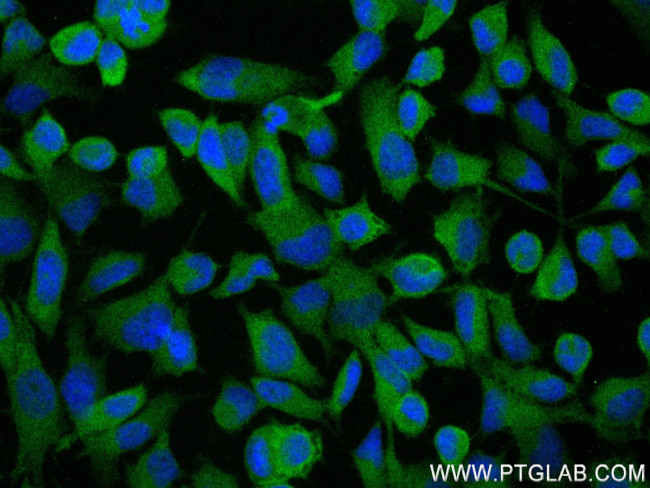 MTMR9 Antibody in Immunocytochemistry (ICC/IF)