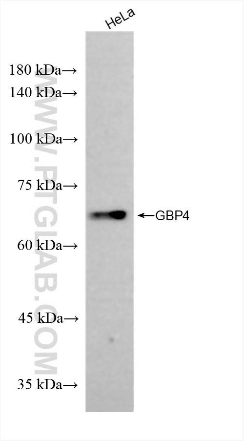 GBP4 Antibody in Western Blot (WB)