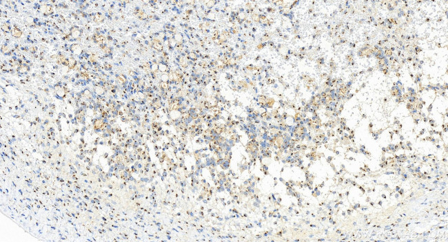 GALNT2 Antibody in Immunohistochemistry (Paraffin) (IHC (P))