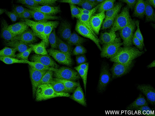Beta galactosidase Antibody in Immunocytochemistry (ICC/IF)