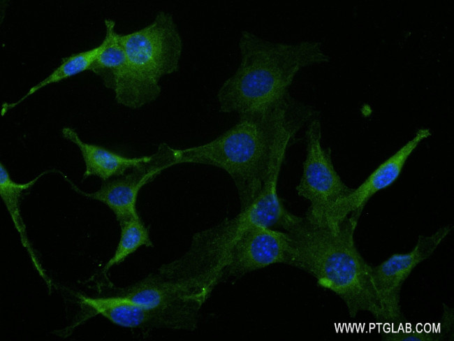 RAP1A Antibody in Immunocytochemistry (ICC/IF)