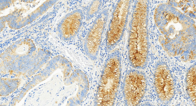 ULBP2 Antibody in Immunohistochemistry (Paraffin) (IHC (P))