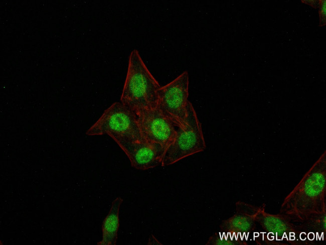 RAE1 Antibody in Immunocytochemistry (ICC/IF)