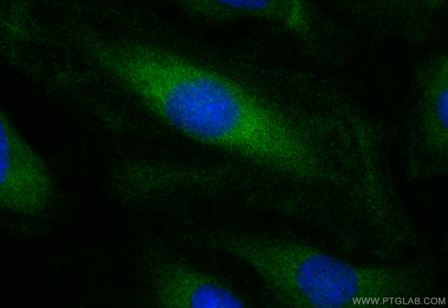 Bif-1 Antibody in Immunocytochemistry (ICC/IF)