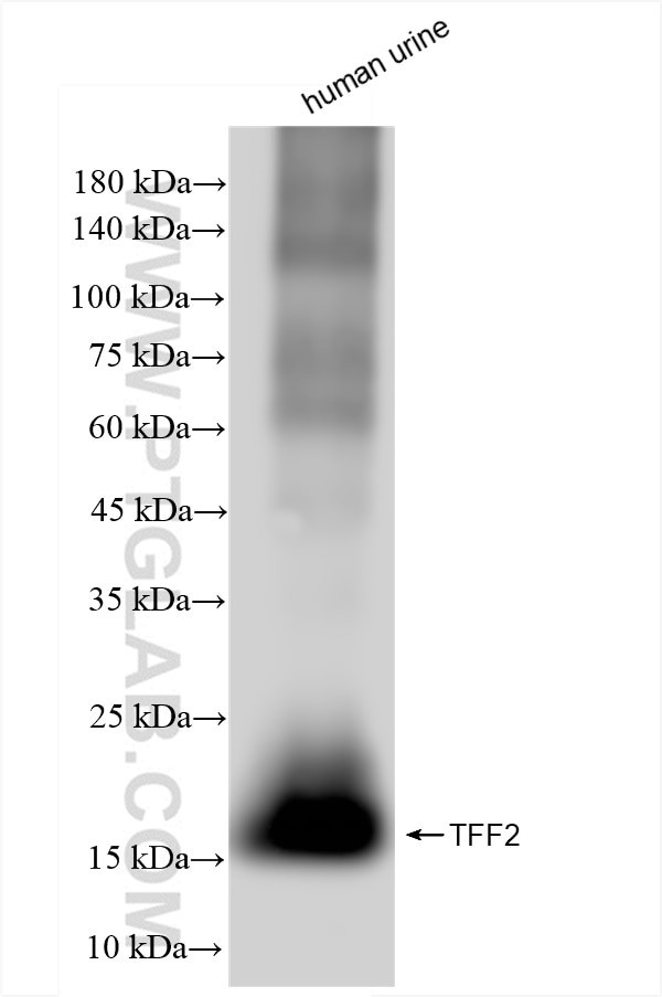 TFF2 Antibody in Western Blot (WB)