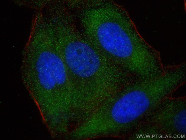 Apolipoprotein E Antibody in Immunocytochemistry (ICC/IF)