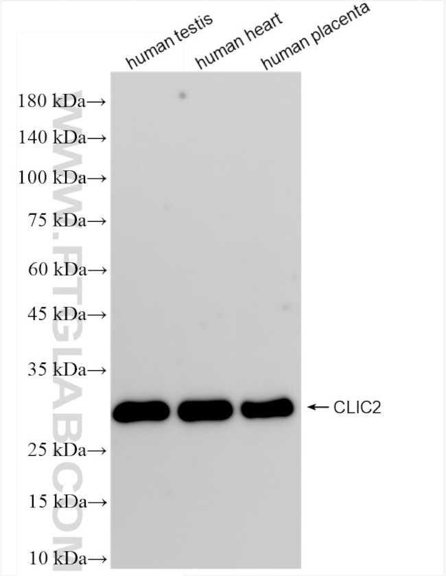 CLIC2 Antibody in Western Blot (WB)