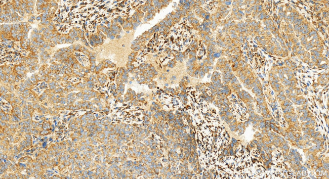 ACOX1 Antibody in Immunohistochemistry (Paraffin) (IHC (P))
