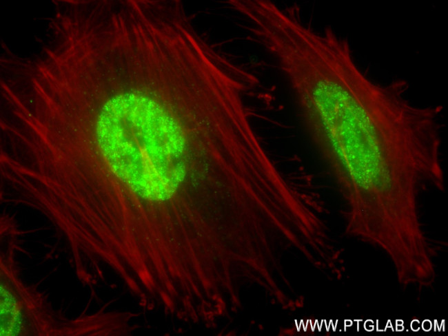 POT1 Antibody in Immunocytochemistry (ICC/IF)