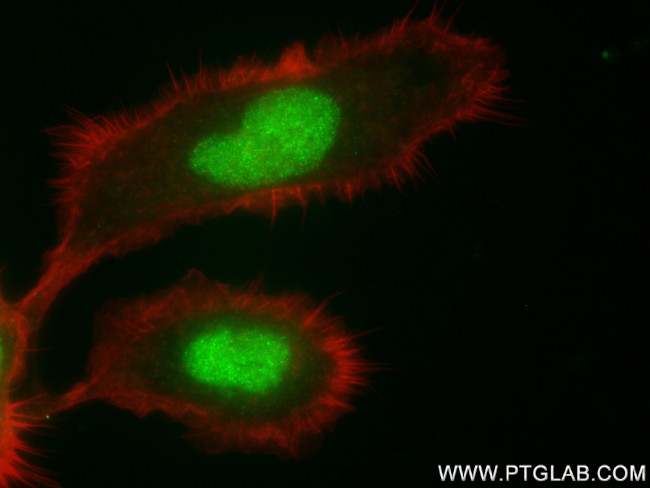 FOXK2 Antibody in Immunocytochemistry (ICC/IF)