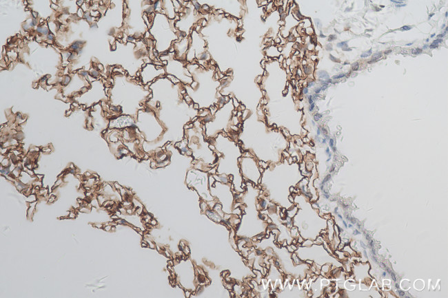 Ager/Rage Antibody in Immunohistochemistry (Paraffin) (IHC (P))