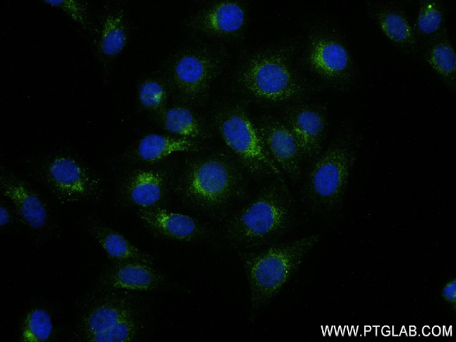 Cathepsin D Antibody in Immunocytochemistry (ICC/IF)