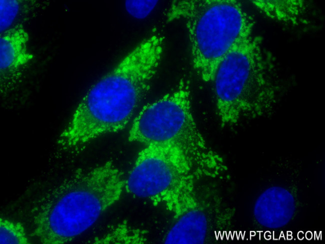 COL1A2 Antibody in Immunocytochemistry (ICC/IF)
