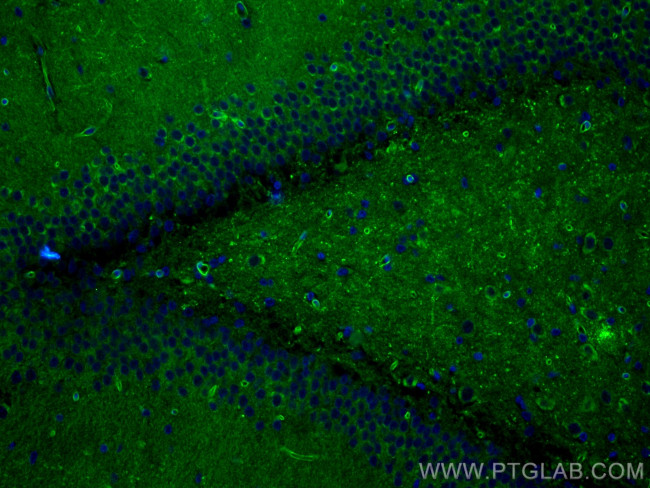 AGER/RAGE Antibody in Immunohistochemistry (PFA fixed) (IHC (PFA))