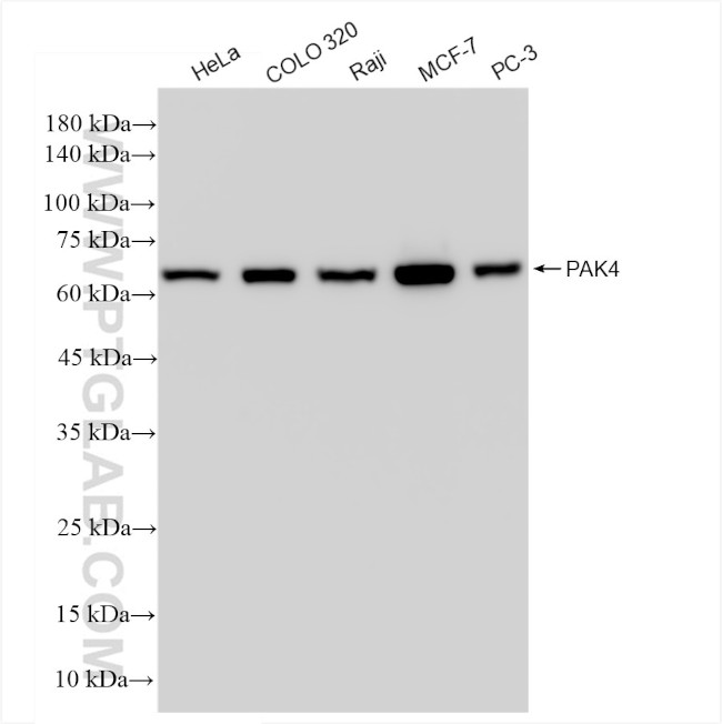 PAK4 Antibody in Western Blot (WB)