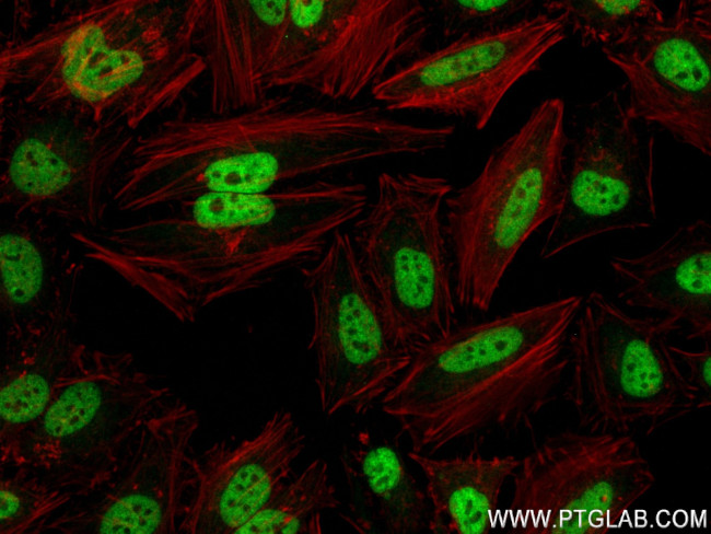 HNRNPA2B1 Antibody in Immunocytochemistry (ICC/IF)