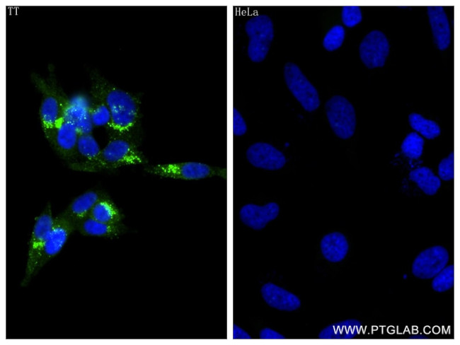 CALCA/CGRP Antibody in Immunocytochemistry (ICC/IF)