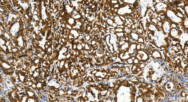 BAG3 Antibody in Immunohistochemistry (Paraffin) (IHC (P))