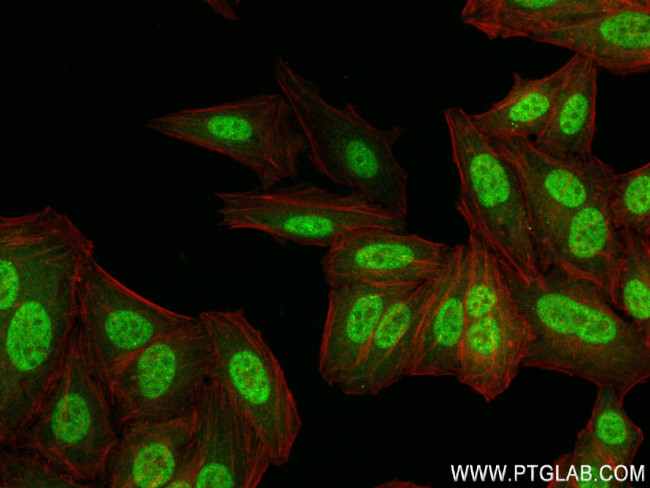 TDG Antibody in Immunocytochemistry (ICC/IF)