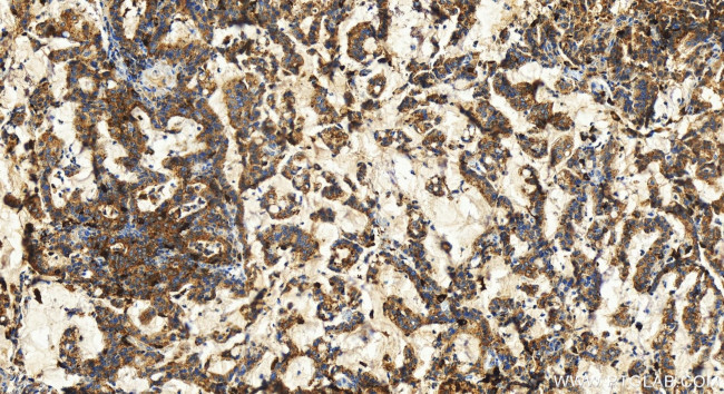 SCPEP1 Antibody in Immunohistochemistry (Paraffin) (IHC (P))