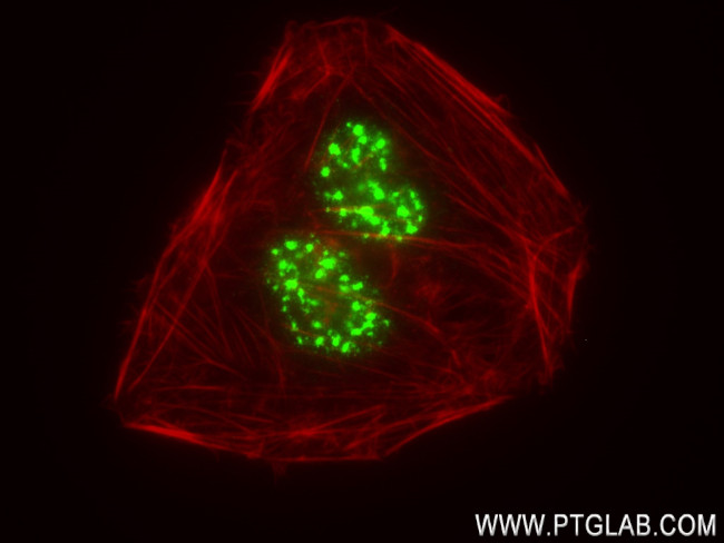 SON Antibody in Immunocytochemistry (ICC/IF)
