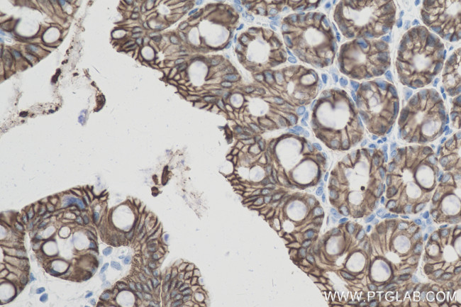 Cadherin-17 Antibody in Immunohistochemistry (Paraffin) (IHC (P))