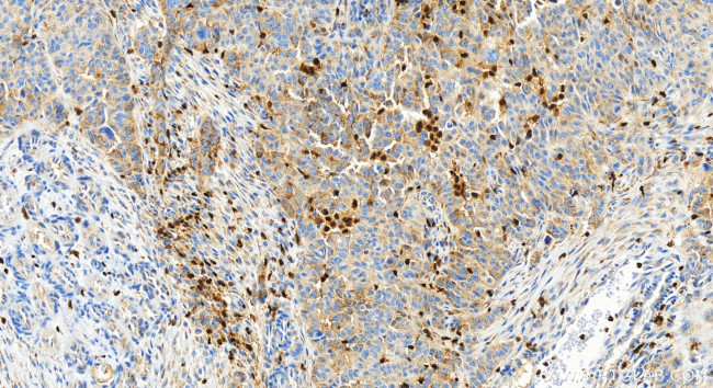 5 Lipoxygenase Antibody in Immunohistochemistry (Paraffin) (IHC (P))