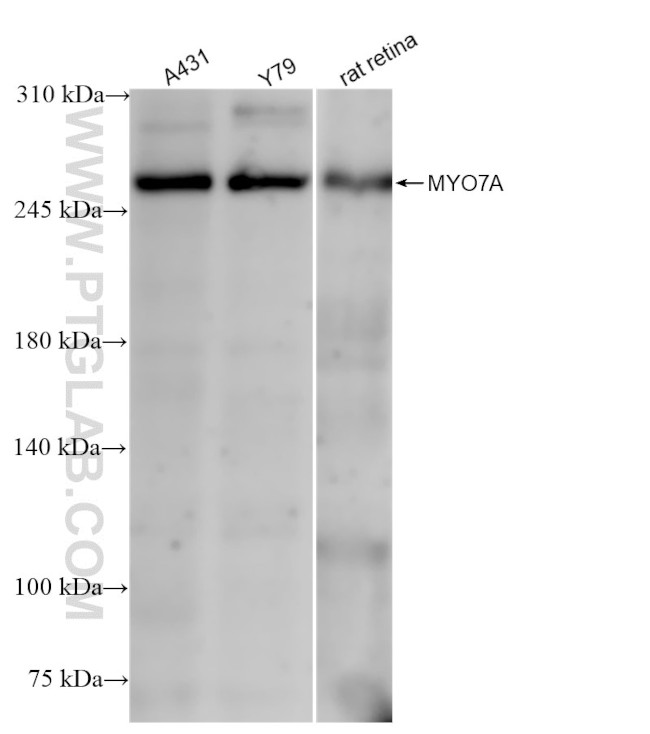 MYO7A Antibody in Western Blot (WB)