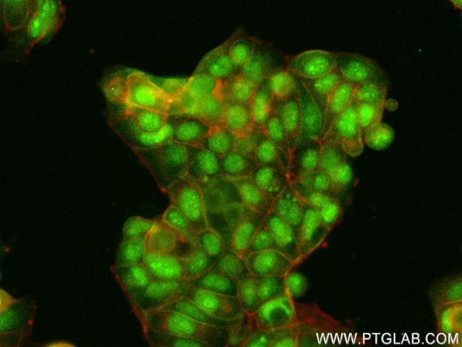 GATA3 Antibody in Immunocytochemistry (ICC/IF)