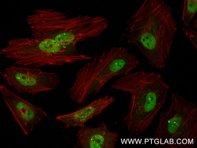 TP53BP1 Antibody in Immunocytochemistry (ICC/IF)