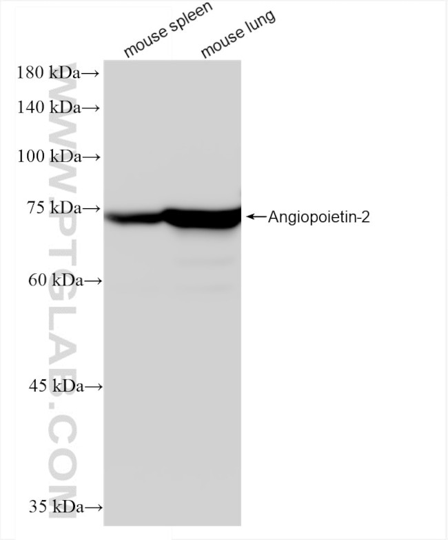 Angiopoietin-2 Antibody in Western Blot (WB)